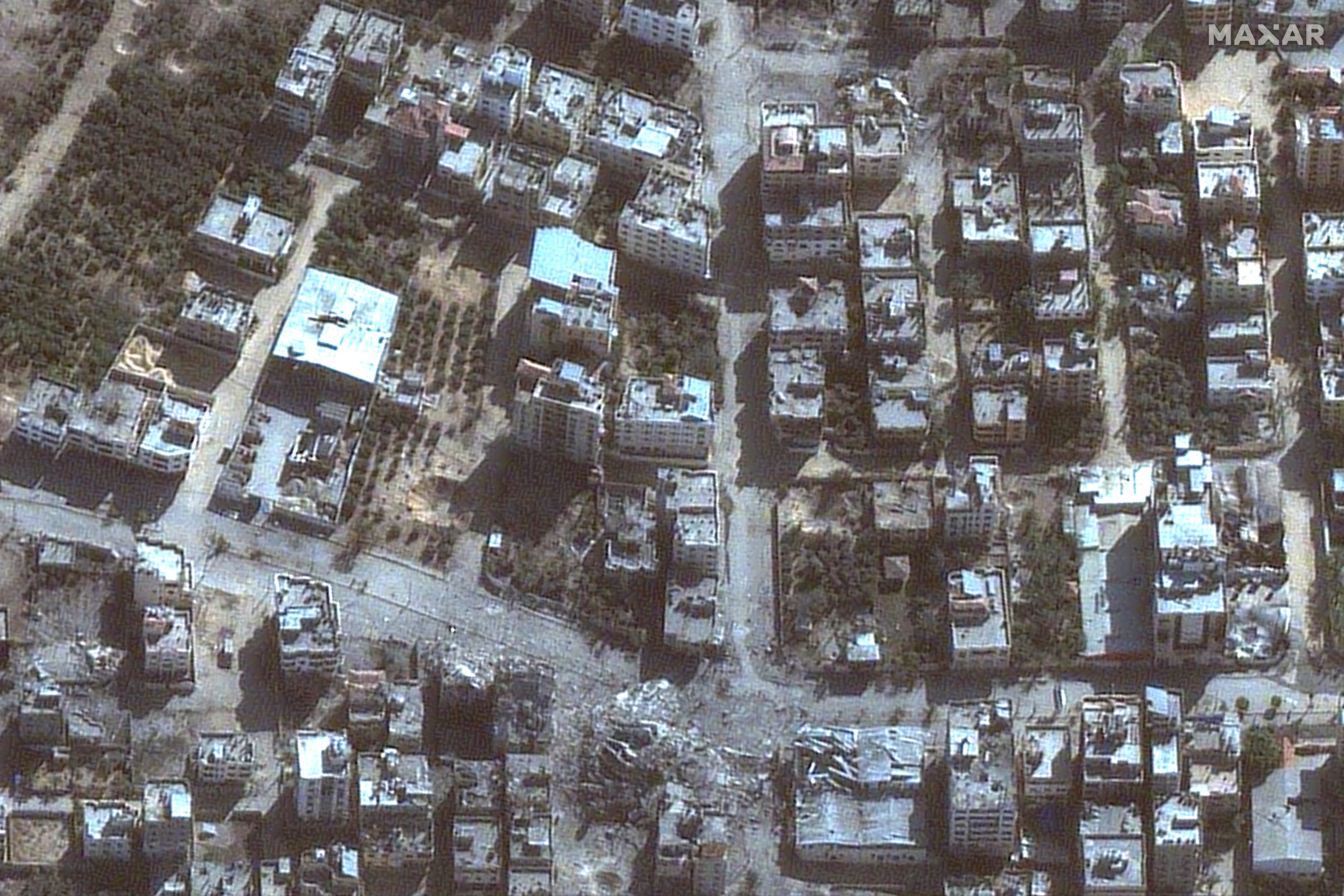 PALESTINIAN-ISRAEL-CONFLICT-HOSPITAL